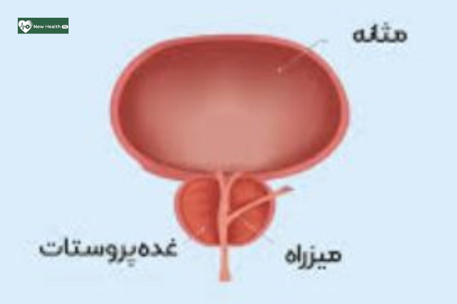 زنگ هشدار برای سلامت مردان؛ بزرگ شدن پروستات را جدی بگیرید